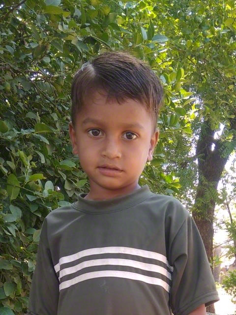 World Vision India